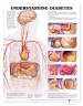Understanding Diabetes