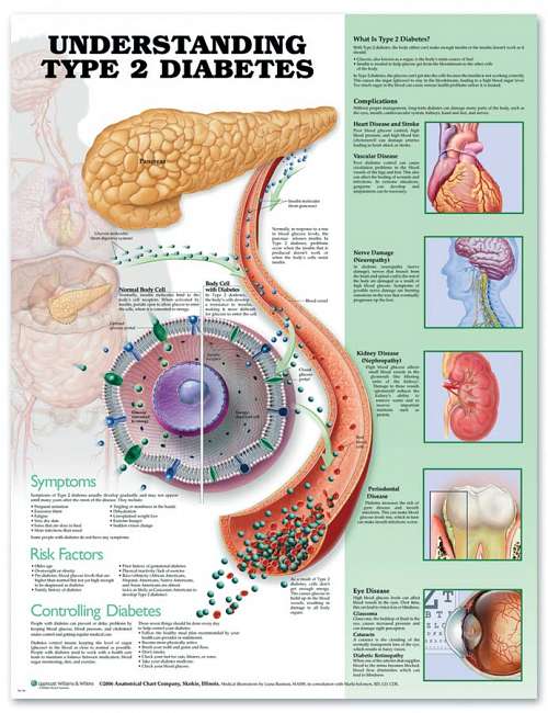Understanding Type 2 Diabetes Understanding Type 2 Diabetes