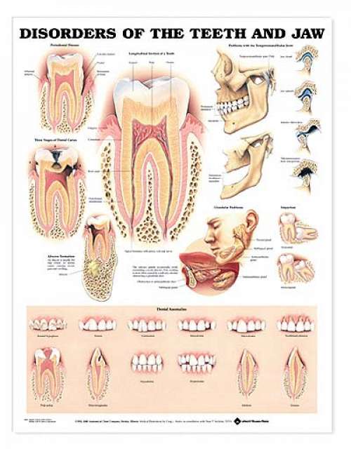 Disorders of the Teeth and Jaw Anatomical Chart Disorders of the Teeth and Jaw Anatomical Chart