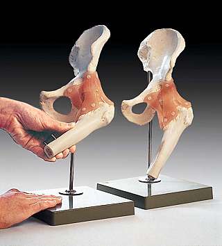 Functional Model of the Hip Joint