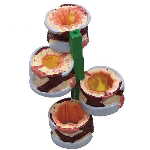 4 Piece Bronchus Model 4 Piece Bronchus Model