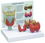 Thyroid Model