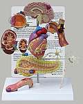 Type II Diabetes Set