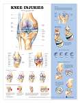 Knee Injuries