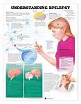 Understanding Epilepsy