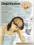 Understanding Depression