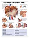 Understanding Hepatitis - Paper
