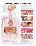 Understanding Diabetes