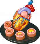 Heart Conditions Model