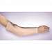 DermaSaver Arm Tube