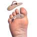 Hammer Toe Crests