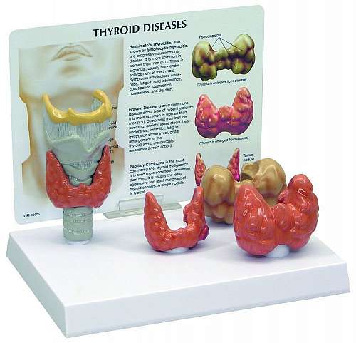 Thyroid Model