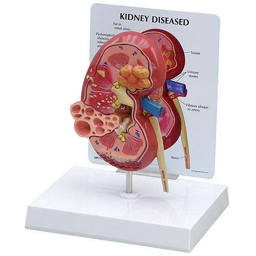 Kidney Normal/Pathology Model