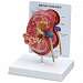 Kidney Normal/Pathology Model