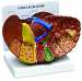 Liver with Pathologies