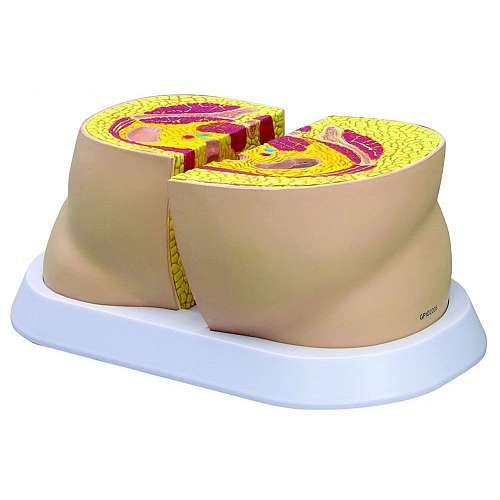 Obesity Model