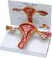 Uterus/Ovary Model
