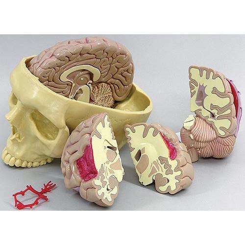 Brain Model