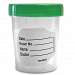 AmSure Urine Specimen Container