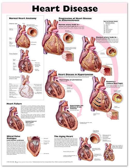 Heart Disease