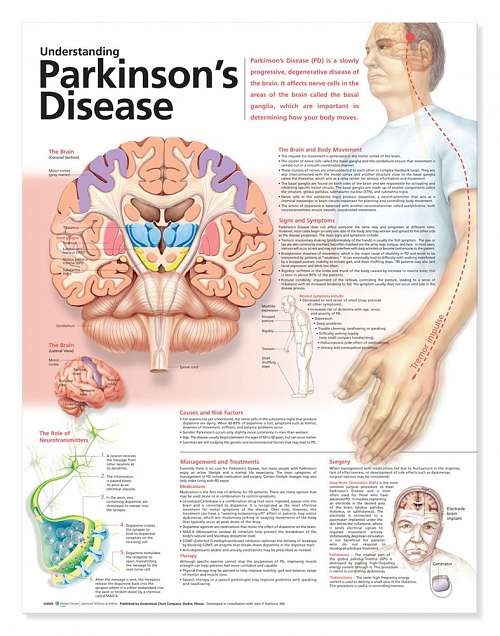 Understanding Parkinson