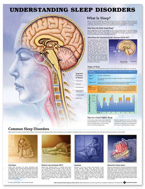 Understanding Sleep Disorders