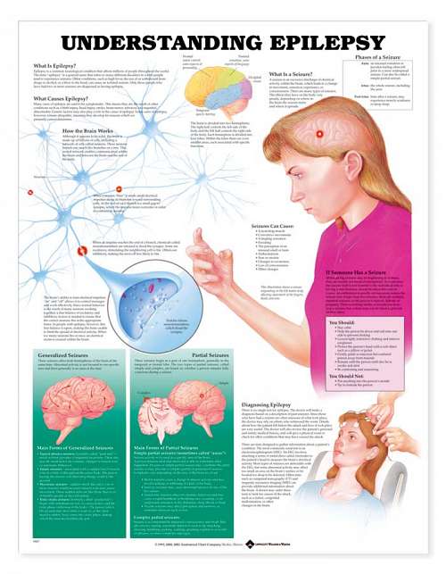 Understanding Epilepsy