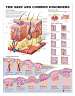 The Skin and Common Disorders