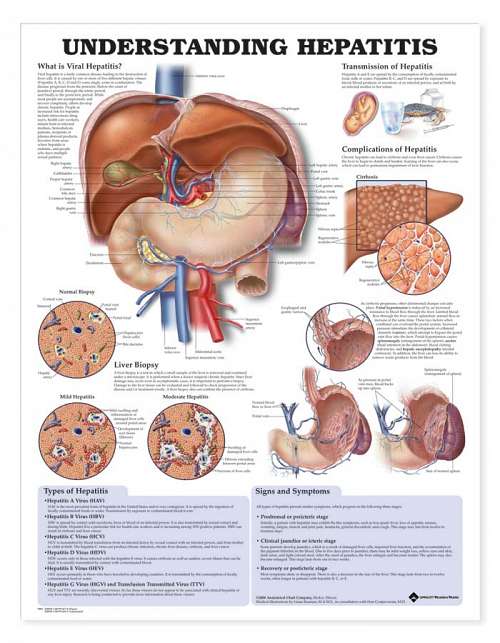 Understanding Hepatitis