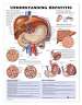 Understanding Hepatitis