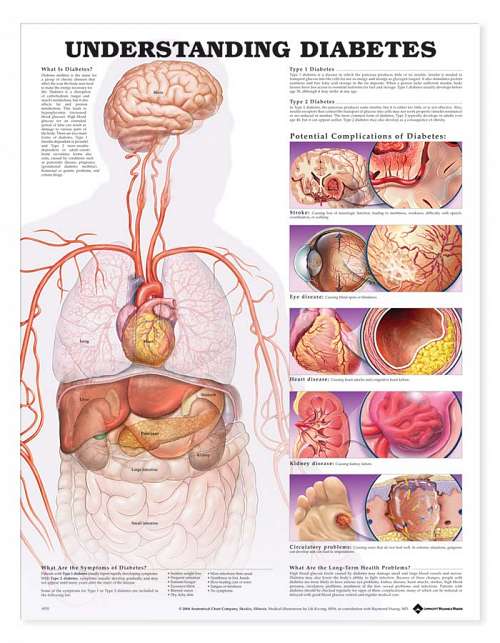 Understanding Diabetes