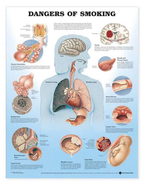 Dangers of Smoking