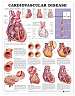 Cardiovascular Disease Anatomical Chart