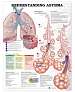 Understanding Asthma Anatomical Chart 2nd Edition