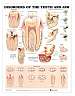 Disorders of the Teeth and Jaw Anatomical Chart