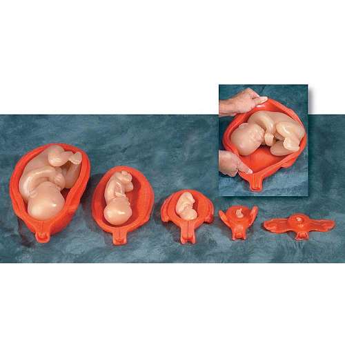 Uterus with Fetus Model Set