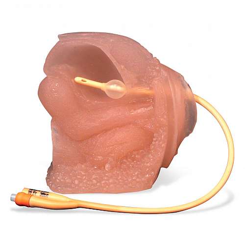 Female Model With Bladder
