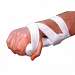 Grip Splint II
